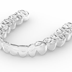 Orthodontie – Traitement Invisalign